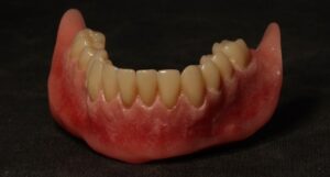 Picture of suction dentures with black background.