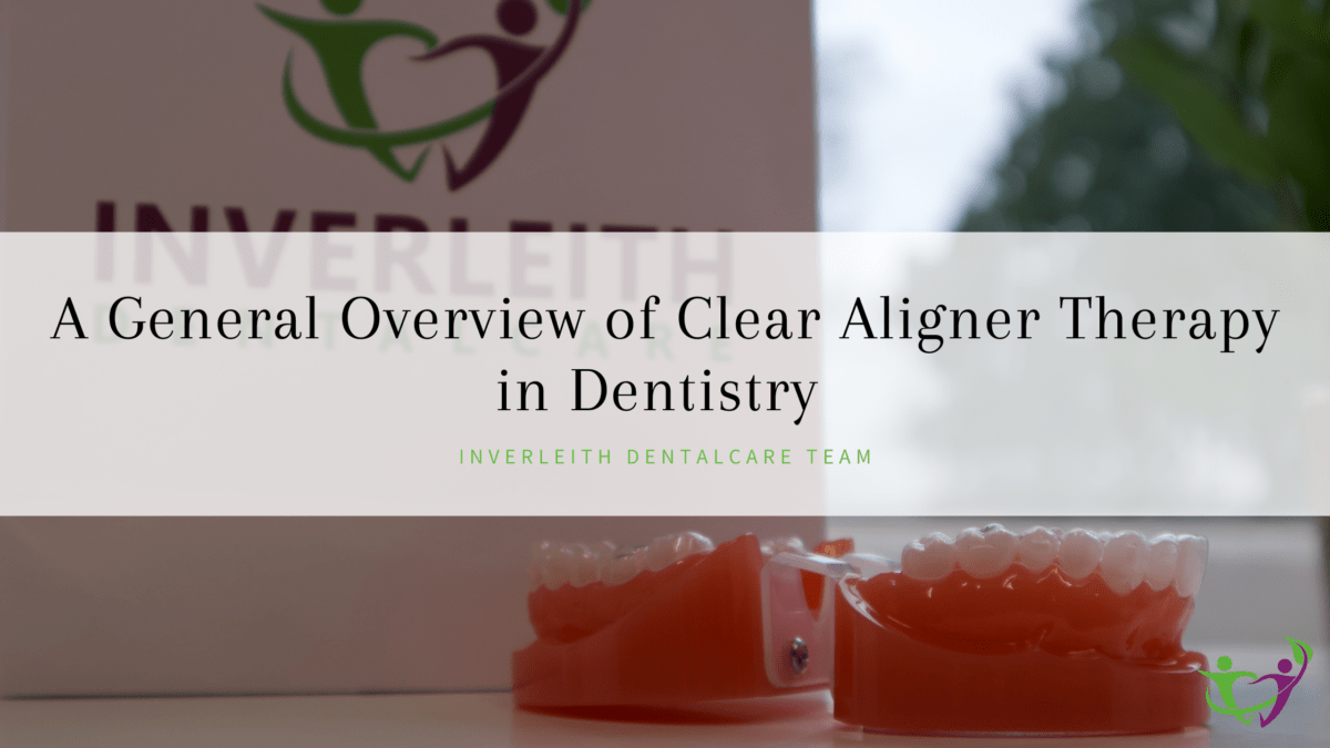 A General Overview of Clear Aligner Therapy in Dentistry – Inverleith ...